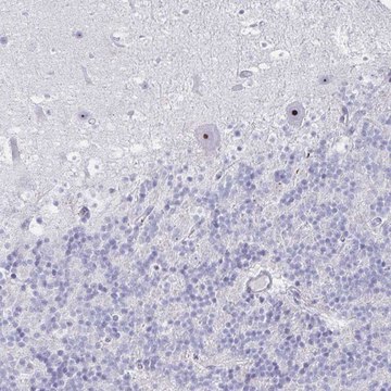 Anti-DLK2 antibody produced in rabbit Prestige Antibodies&#174; Powered by Atlas Antibodies, affinity isolated antibody, buffered aqueous glycerol solution