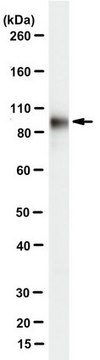 Anti-Plakophilin-3 Antibody, clone 7F6 clone 7F6, from mouse