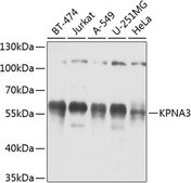 Anti-KPNA3 antibody produced in rabbit