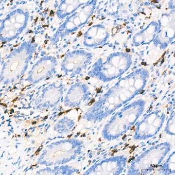 Anti-S100A8 Antibody, clone 5Z7U8, Rabbit Monoclonal