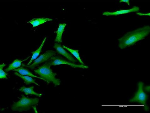 Anti-FBXO42 antibody produced in rabbit purified immunoglobulin, buffered aqueous solution