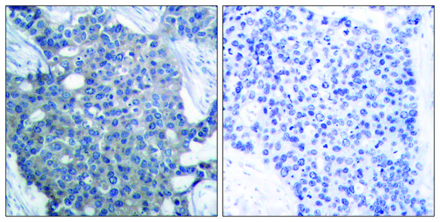 Anti-Stathmin 1 antibody produced in rabbit affinity isolated antibody