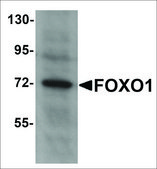 Anti-FOXO1 antibody produced in rabbit affinity isolated antibody, buffered aqueous solution
