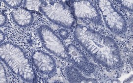 Anti-Na+/K+ ATPase α1 Antibody, clone 2M18 ZooMAb® Rabbit Monoclonal recombinant, expressed in HEK 293 cells