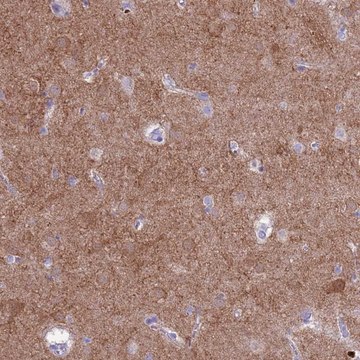 Anti-PDE10A antibody produced in rabbit Prestige Antibodies&#174; Powered by Atlas Antibodies, affinity isolated antibody, buffered aqueous glycerol solution