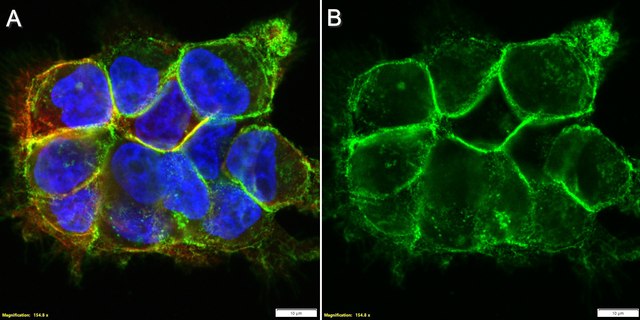 Anti-ITGA3 Antibody, clone P1B5 ZooMAb&#174; Mouse Monoclonal recombinant, expressed in HEK 293 cells