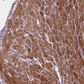 Anti-GOT1 antibody produced in rabbit Prestige Antibodies® Powered by Atlas Antibodies, affinity isolated antibody