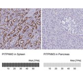 Anti-PITPNM3 antibody produced in rabbit Prestige Antibodies® Powered by Atlas Antibodies, affinity isolated antibody, buffered aqueous glycerol solution