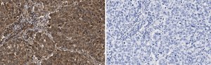 Anti-Skp2 Antibody, clone 1B13 ZooMAb® Rabbit Monoclonal recombinant, expressed in HEK 293 cells