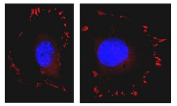 Anti-FAK Antibody, clone 4.47, Alexa Fluor&#8482; 555 conjugate clone 4.47, Upstate&#174;, from mouse