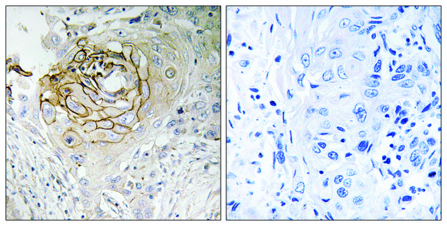 Anti-SCN9A antibody produced in rabbit affinity isolated antibody