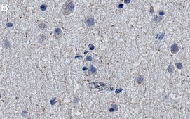 Anti-RBM39 Antibody, clone 1H21 ZooMAb® Rabbit Monoclonal recombinant, expressed in HEK 293 cells