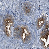 Anti-DNAJC5 antibody produced in rabbit Prestige Antibodies® Powered by Atlas Antibodies, affinity isolated antibody, buffered aqueous glycerol solution