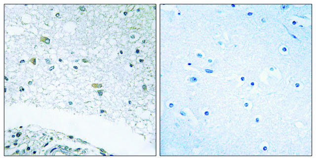 Anti-LAMC3 antibody produced in rabbit affinity isolated antibody