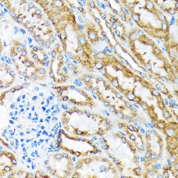 Anti-MSP/MST1 antibody produced in rabbit