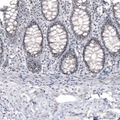 Monoclonal Anti-NIFK antibody produced in mouse Prestige Antibodies® Powered by Atlas Antibodies, clone CL2240, purified immunoglobulin, buffered aqueous glycerol solution