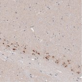 Monoclonal Anti-CTGF antibody produced in mouse Prestige Antibodies® Powered by Atlas Antibodies, clone CL5339, purified immunoglobulin, buffered aqueous glycerol solution