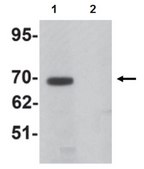 Anti-LRRTM1 Antibody from rabbit, purified by affinity chromatography