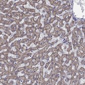 Anti-ACADSB antibody produced in rabbit Prestige Antibodies® Powered by Atlas Antibodies, affinity isolated antibody, buffered aqueous glycerol solution