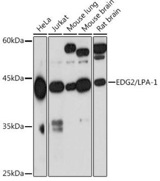 Anti-EDG2/LPA-1 Antibody, clone 3U1Q0, Rabbit Monoclonal