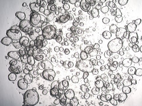 3dGRO Duodenum Intestinal Organoids, Age 59 (Prep ht-230-D)