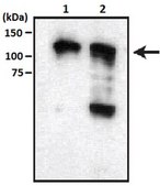 Anti-BICC1/Protein Bicaudal C Homolog 1 Antibody, clone 2D9.1 clone 2D9.1, from mouse