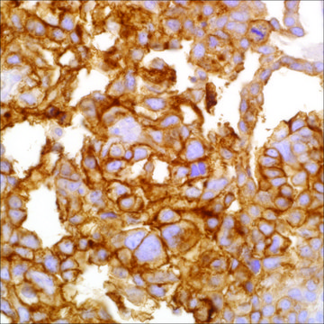 GLUT3 Rabbit Polyclonal Antibody