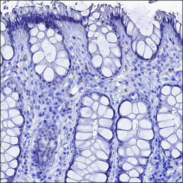 Anti-IRG1 antibody produced in rabbit Prestige Antibodies&#174; Powered by Atlas Antibodies, affinity isolated antibody, buffered aqueous glycerol solution