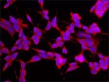 Anti-APP (N-terminal region) antibody produced in rabbit IgG fraction of antiserum