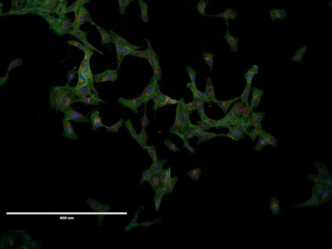 VERO Cell Line from African green monkey kidney, 84113001, A fibroblast-like kidney cell, non-WHO origin, Convention on International Trade in Endangered Species of Wild Fauna and Flora (CITES)