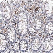 Anti-NRROS antibody produced in rabbit Prestige Antibodies® Powered by Atlas Antibodies, affinity isolated antibody, buffered aqueous glycerol solution