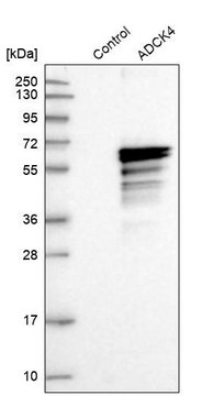 Anti-COQ8B antibody produced in rabbit Prestige Antibodies&#174; Powered by Atlas Antibodies, affinity isolated antibody, buffered aqueous glycerol solution, ab2