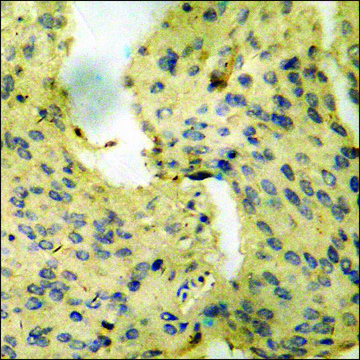 Anti-phospho-VEGFR2 (pTyr1175) antibody produced in rabbit affinity isolated antibody