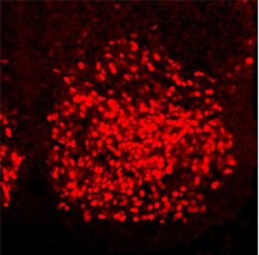 Anti-HOXC6 (C-terminal) antibody produced in rabbit affinity isolated antibody