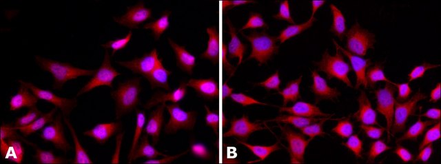 Anti-Histone Deacetylase 4 (HDAC4) antibody, Mouse monoclonal clone HDAC4-144, purified from hybridoma cell culture