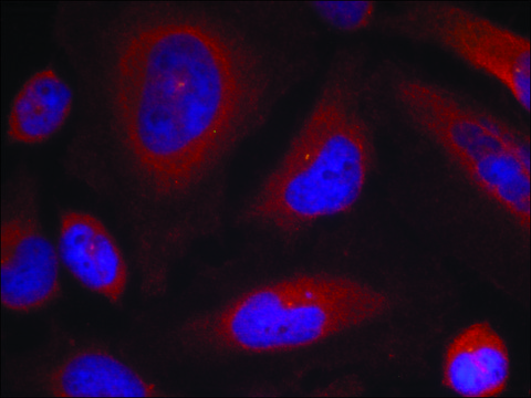 Anti-phospho-SYT1 (pSer309) antibody produced in rabbit affinity isolated antibody