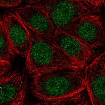 Anti-CDC73 antibody produced in rabbit Prestige Antibodies&#174; Powered by Atlas Antibodies, affinity isolated antibody