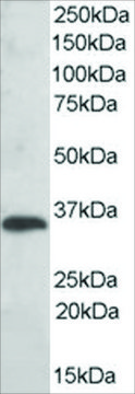 Anti-TXNDC1/TMX antibody produced in goat affinity isolated antibody, buffered aqueous solution