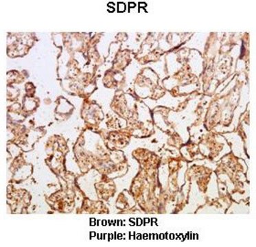 Anti-SDPR antibody produced in rabbit affinity isolated antibody