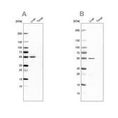 Anti-NAPRT antibody produced in rabbit Prestige Antibodies® Powered by Atlas Antibodies, affinity isolated antibody, buffered aqueous glycerol solution, Ab1