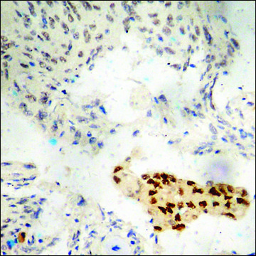 Anti-phospho-Estrogen Receptor-&#945; (pSer118) antibody produced in rabbit affinity isolated antibody