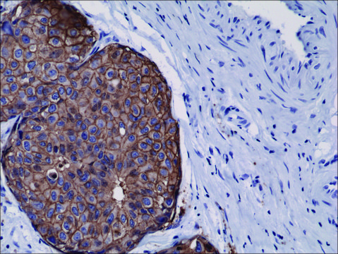 Anti-HER2 antibody, Rabbit monoclonal recombinant, expressed in HEK 293 cells, clone RM228, purified immunoglobulin