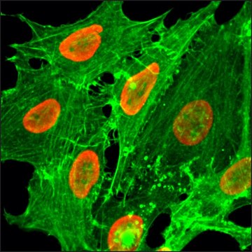 Anti-Acetyl-Histone H2B (Lys20) antibody, Rabbit monoclonal recombinant, expressed in HEK 293 cells, clone RM235, purified immunoglobulin