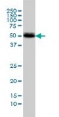 Monoclonal Anti-CANT1 antibody produced in mouse clone 2D3, purified immunoglobulin, buffered aqueous solution