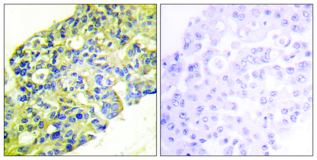 抗-PI3-激酶 p85-&#945; 兔抗 affinity isolated antibody