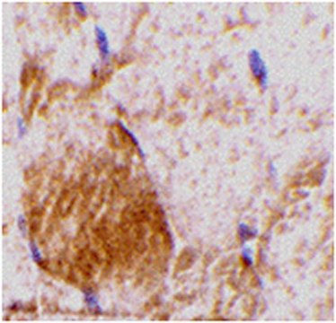 Anti-IL-31 Antibody from rabbit, purified by affinity chromatography