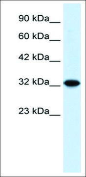 Anti-ZBTB32 antibody produced in rabbit affinity isolated antibody