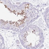 Anti-ACR antibody produced in rabbit Prestige Antibodies® Powered by Atlas Antibodies, affinity isolated antibody, buffered aqueous glycerol solution