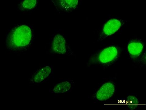 Monoclonal Anti-HOXD3 antibody produced in mouse clone 1B12, purified immunoglobulin, buffered aqueous solution