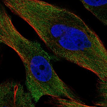 Anti-Ppp3Cc Antibody Produced In Rabbit Prestige Antibodies&#174; Powered by Atlas Antibodies, affinity isolated antibody, buffered aqueous glycerol solution